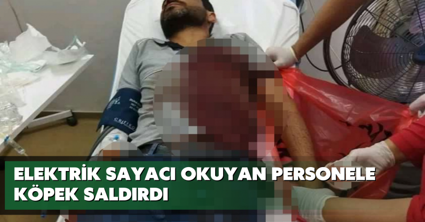 Elektrik sayacı okuyan personele köpek saldırdı