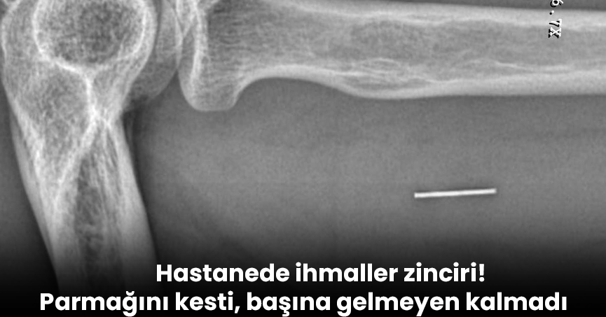 Hastanede ihmaller zinciri! Parmağını kesti, başına gelmeyen kalmadı