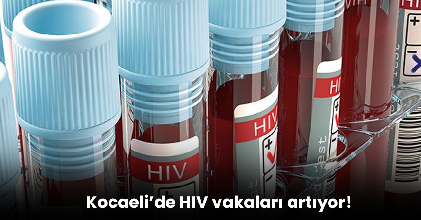 Kocaeli’de HIV vakaları artıyor!